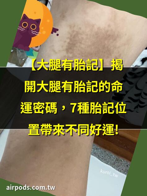 腿上有胎記好不好｜胎記的位置與命運圖解，全面解析