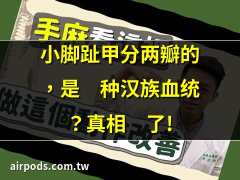 小拇指沒有指甲