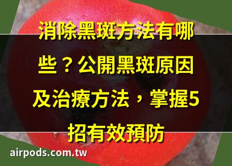 消除黑斑方法有哪些？公開黑斑原因及治療方法，掌握5招有效預防｜面上黑斑
