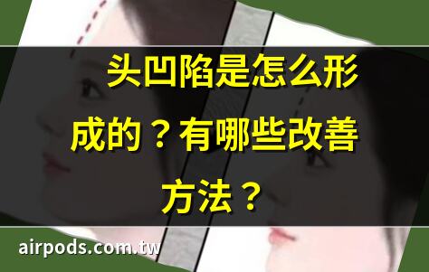 額頭中間有凹陷面相 額頭中間有凹陷是什麼命運｜額頭有凹陷什麼原因